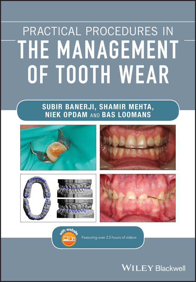Обложка книги «Practical Procedures in the Management of Tooth Wear»