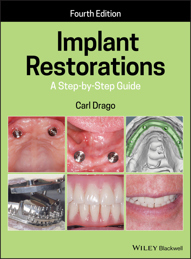 Обложка книги «Implant Restorations»