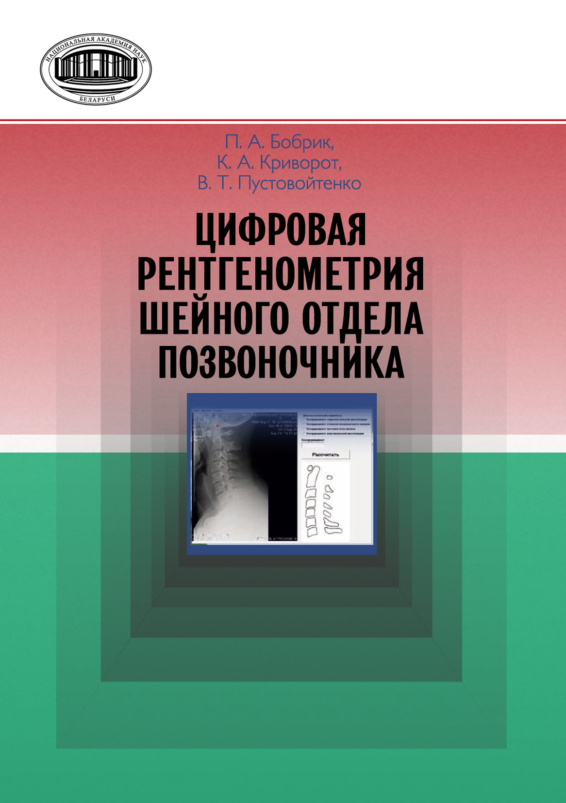 Обложка книги «Цифровая рентгенометрия шейного отдела позвоночника»