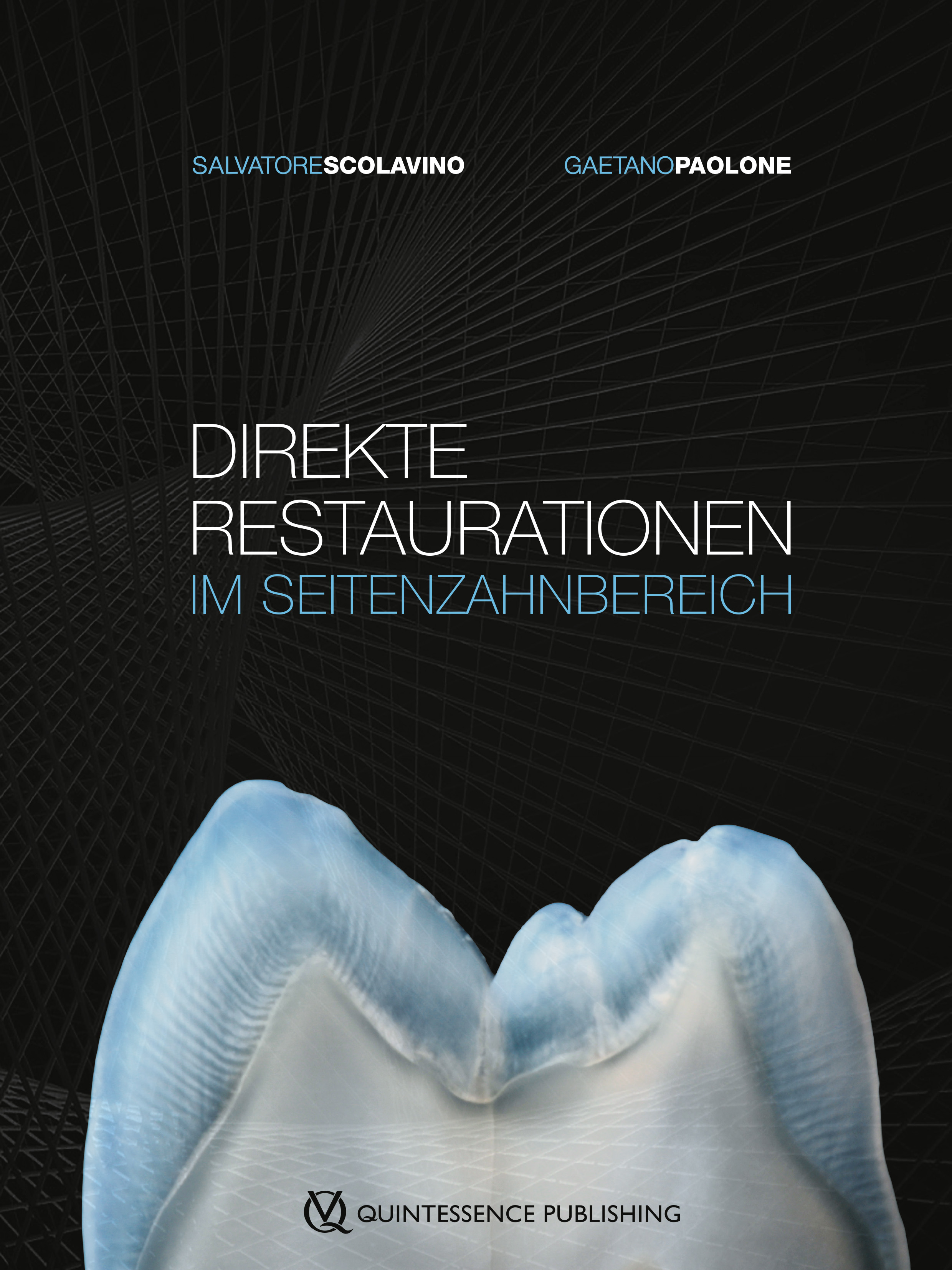 Обложка книги «Direkte Restaurationen im Seitenzahnbereich»