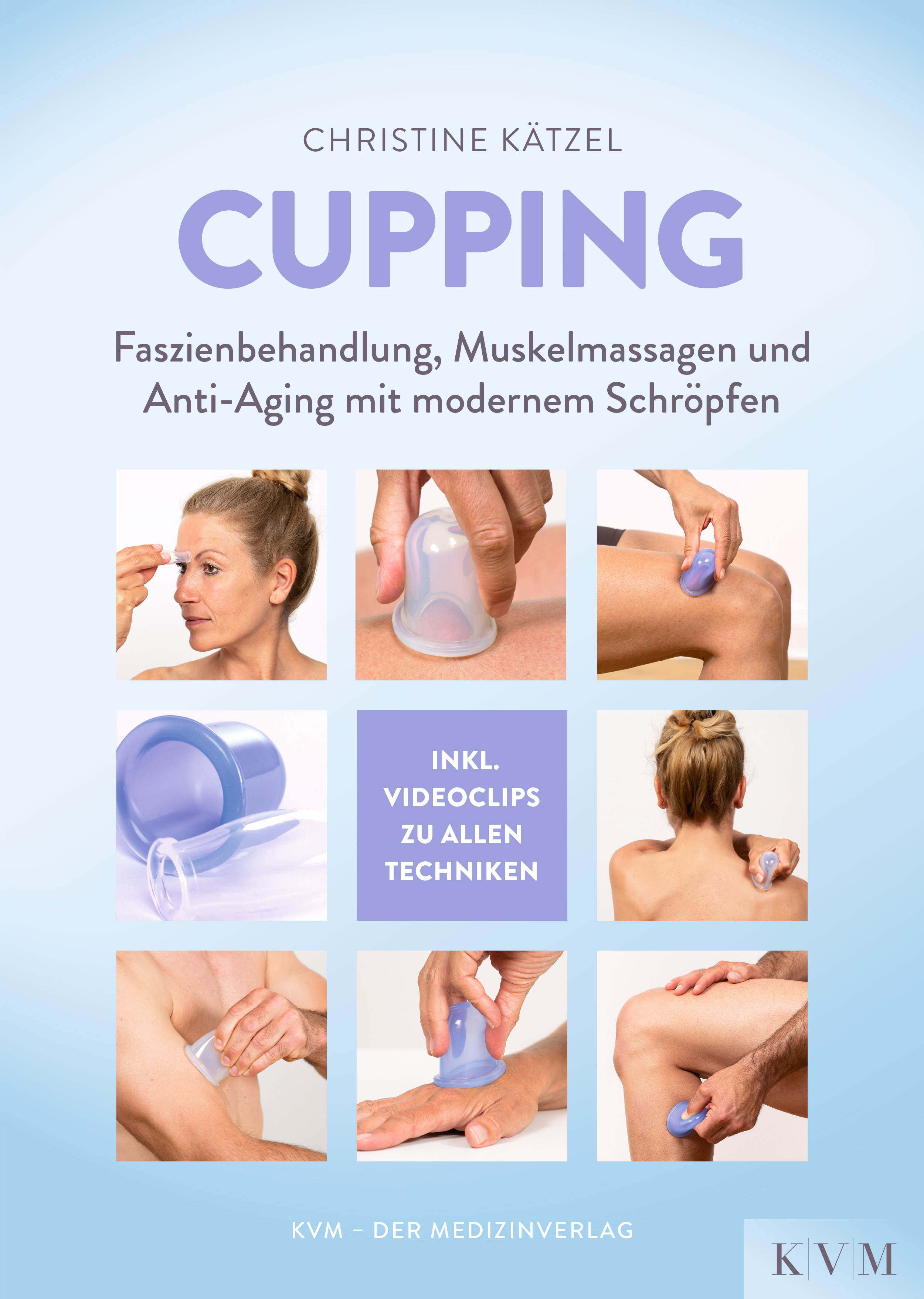 Обложка книги «Cupping»