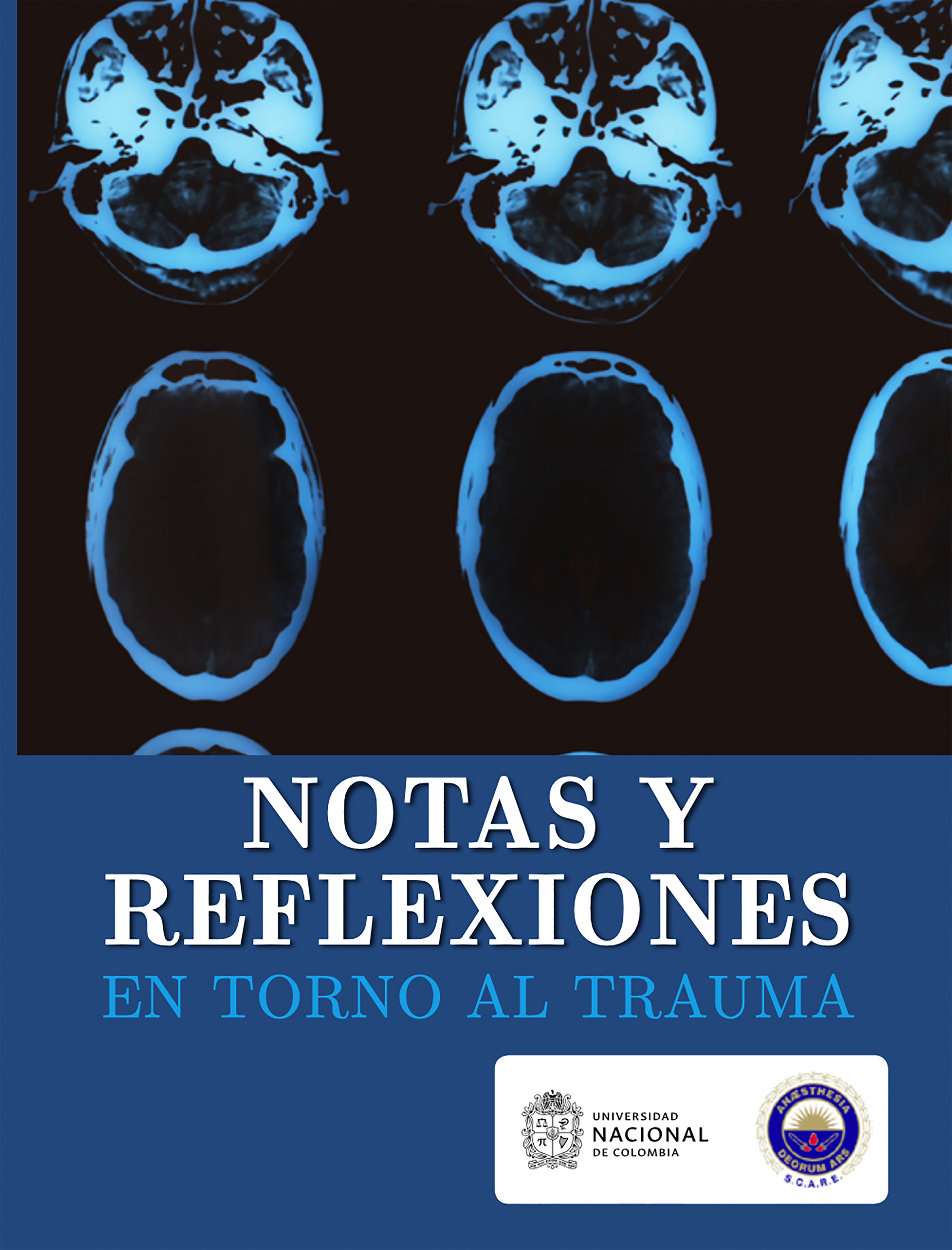 Обложка книги «Notas y reflexiones en torno al trauma»