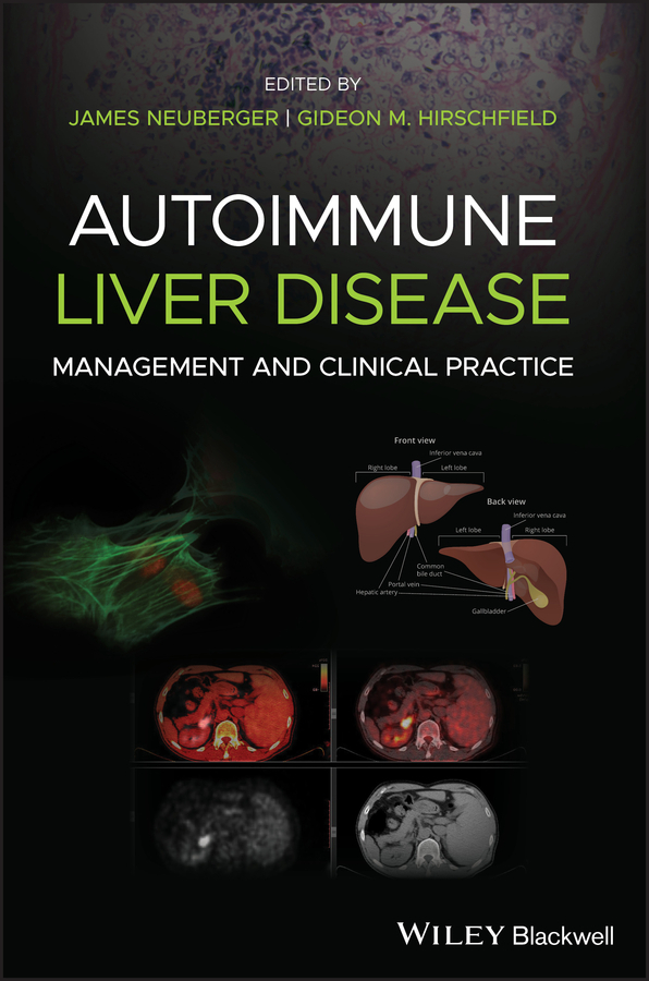 Обложка книги «Autoimmune Liver Disease»