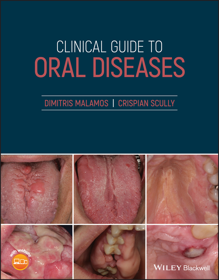 Обложка книги «Clinical Guide to Oral Diseases»