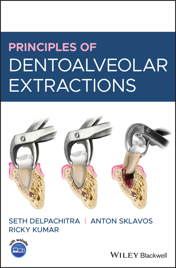 Обложка книги «Principles of Dentoalveolar Extractions»