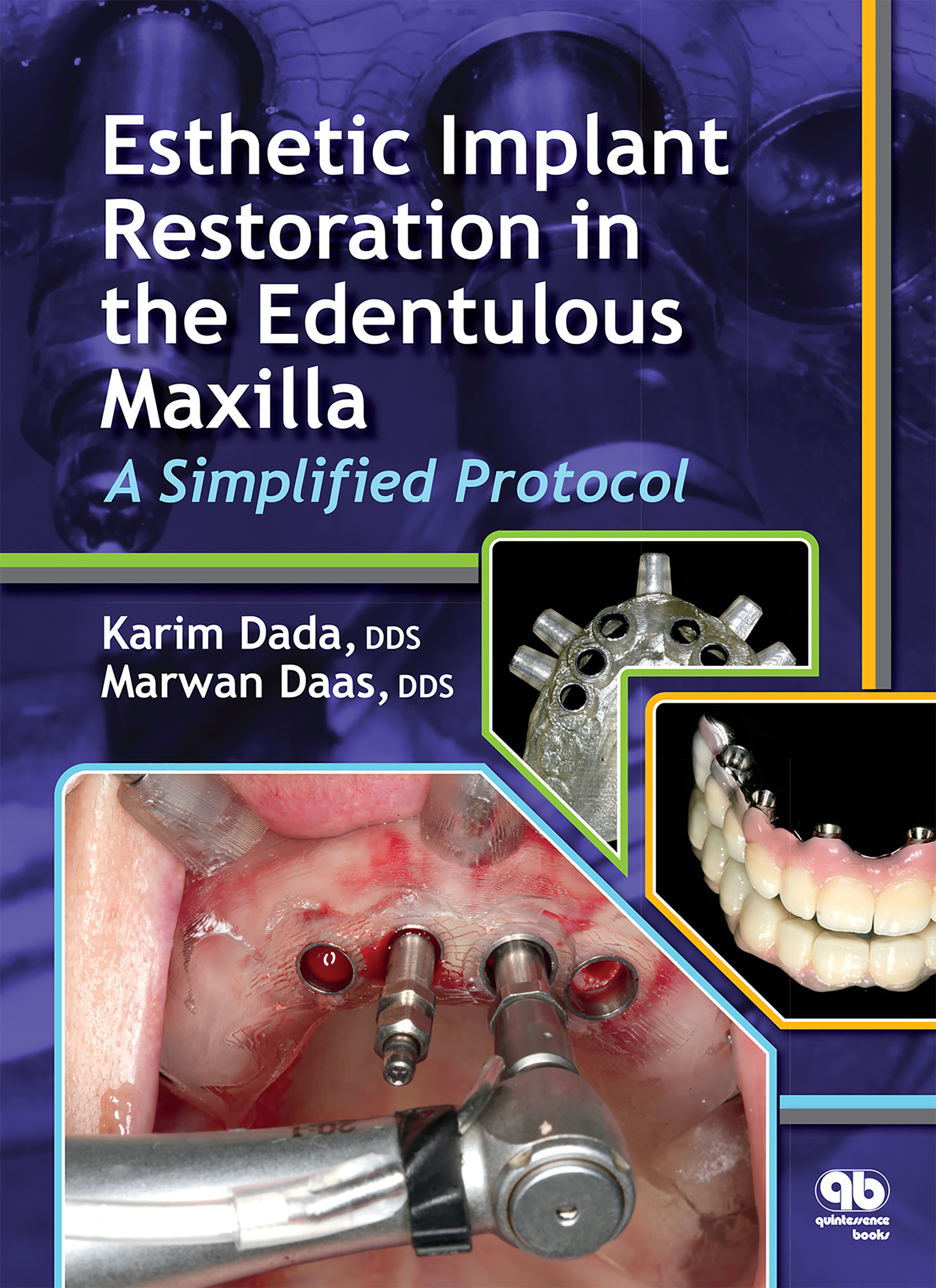 Обложка книги «Esthetic Implant Restoration in the Edentulous Maxilla»