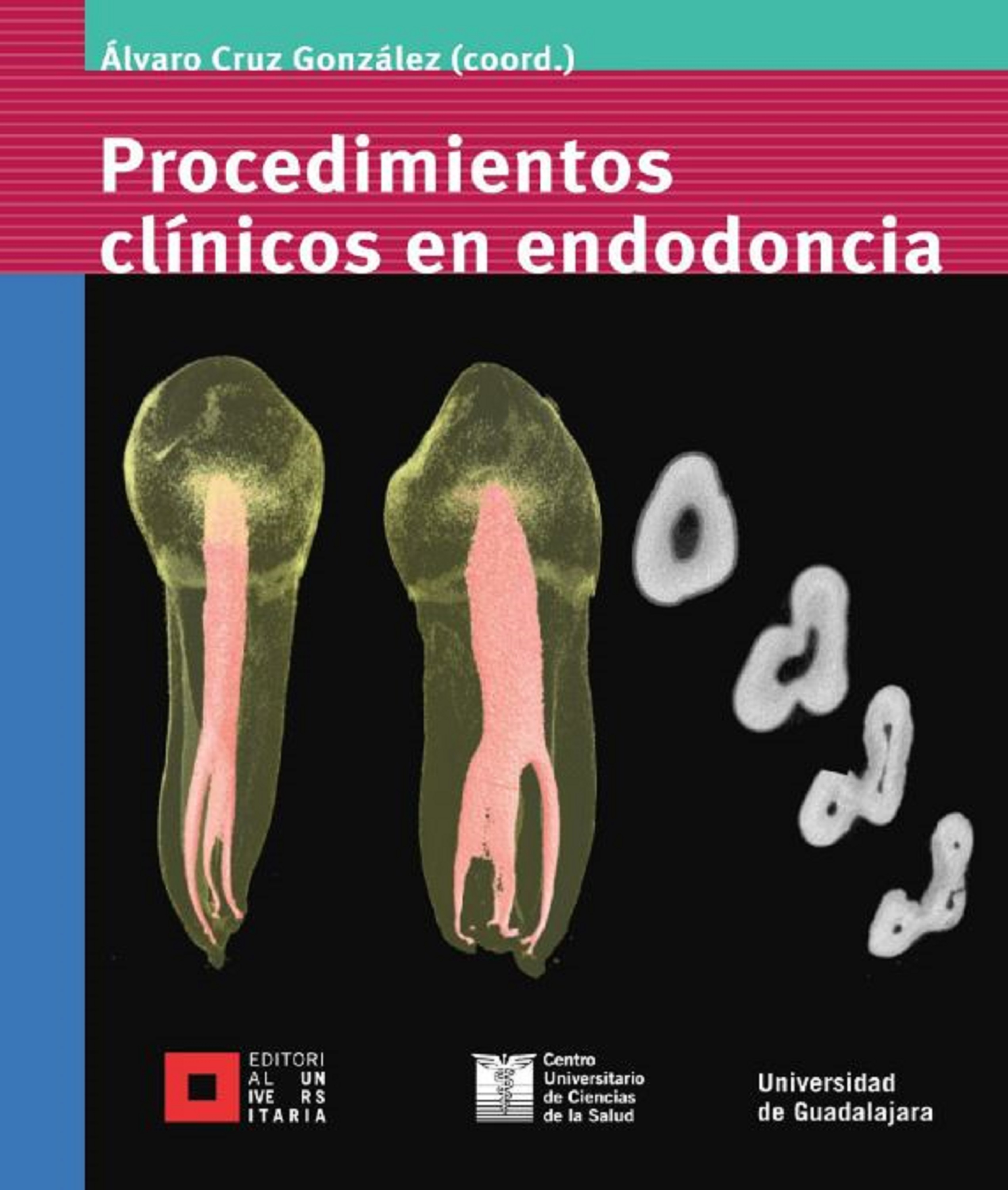 Обложка книги «Procedimientos clínicos en endodoncia»