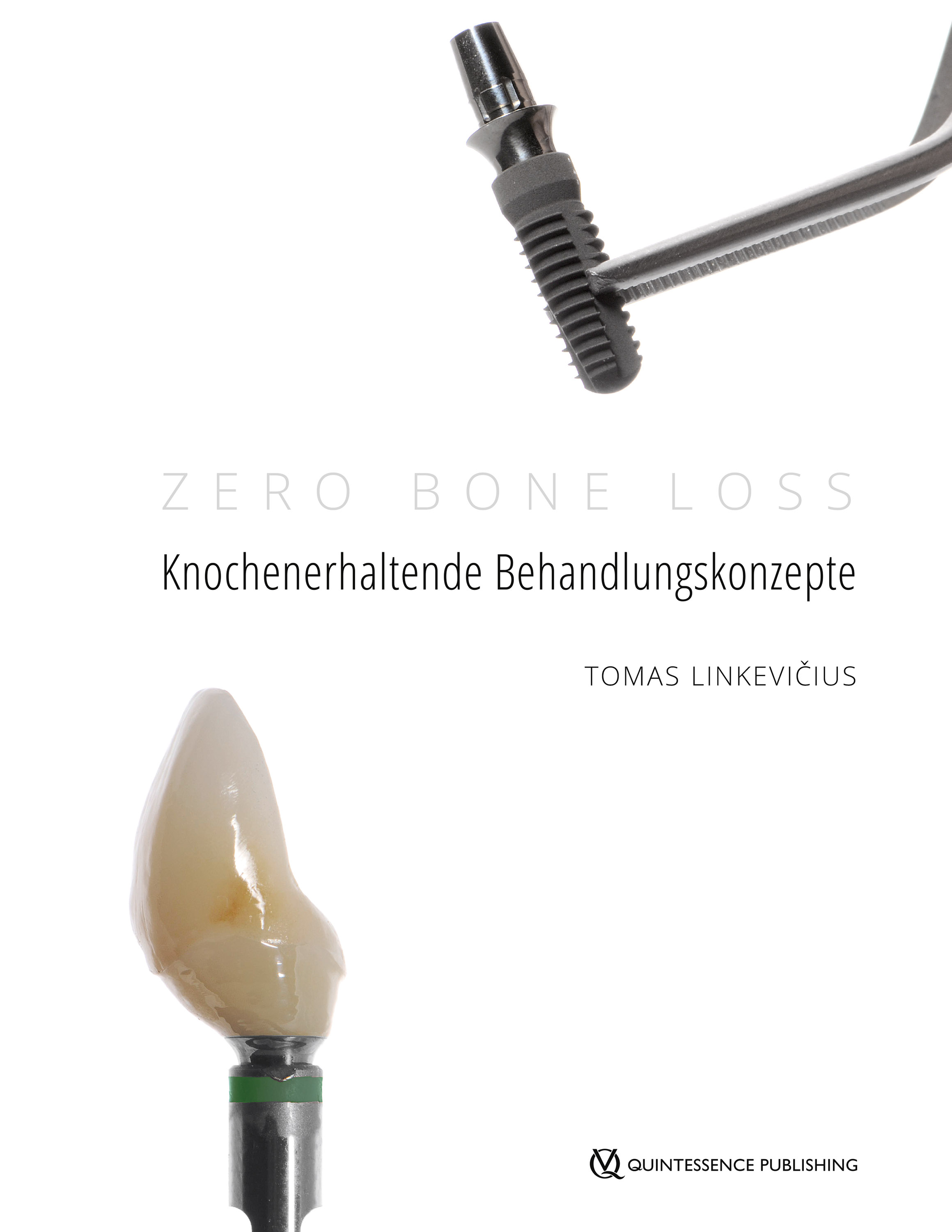 Обложка книги «Zero Bone Loss: Knochenerhaltende Behandlungskonzepte»