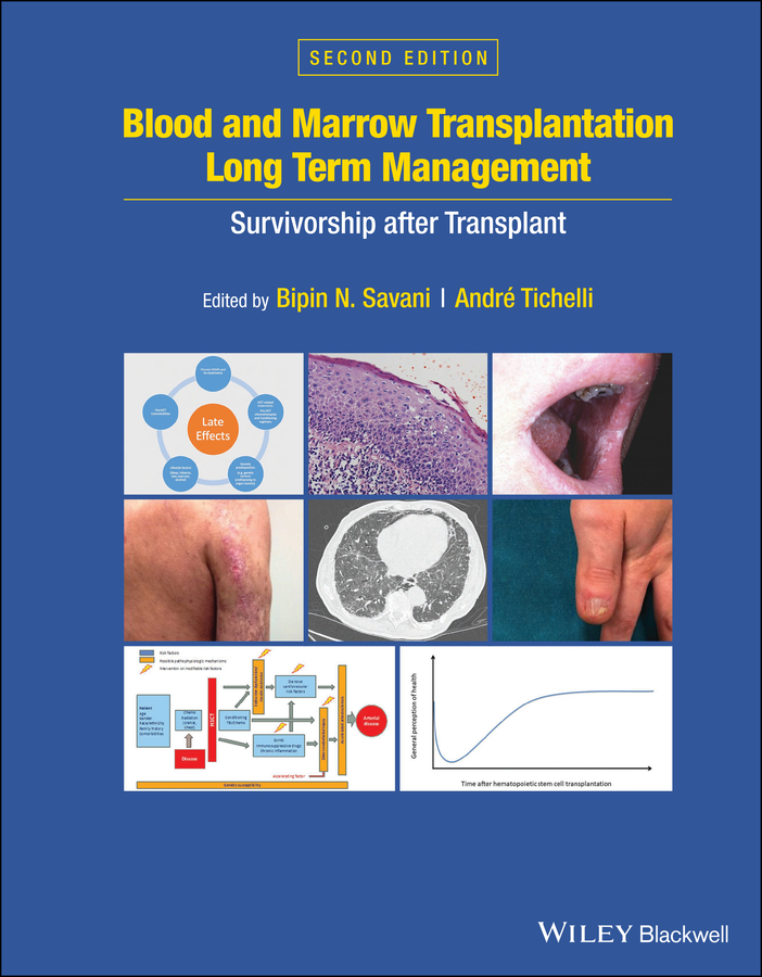 Обложка книги «Blood and Marrow Transplantation Long Term Management»
