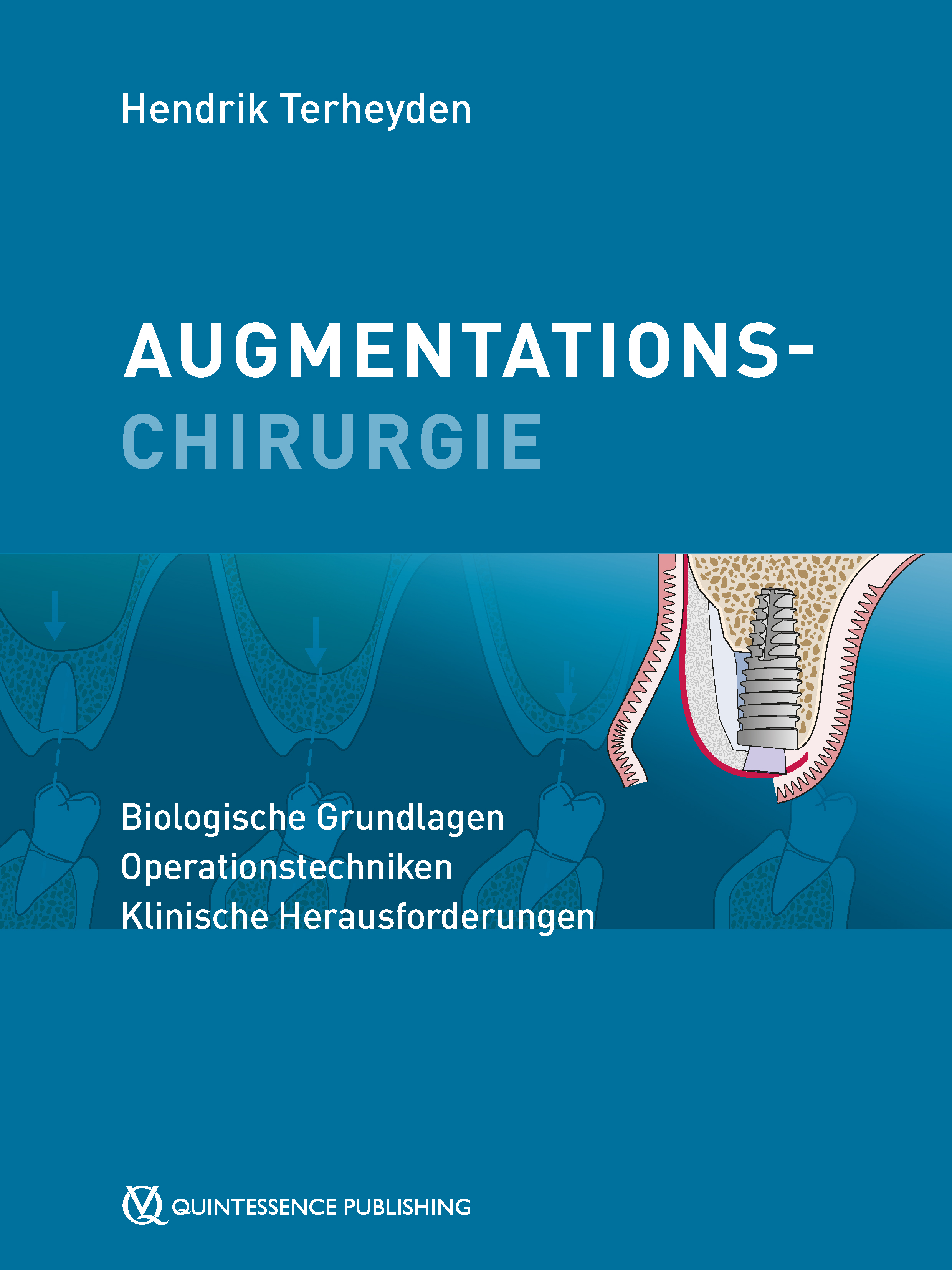 Обложка книги «Augmentationschirurgie»