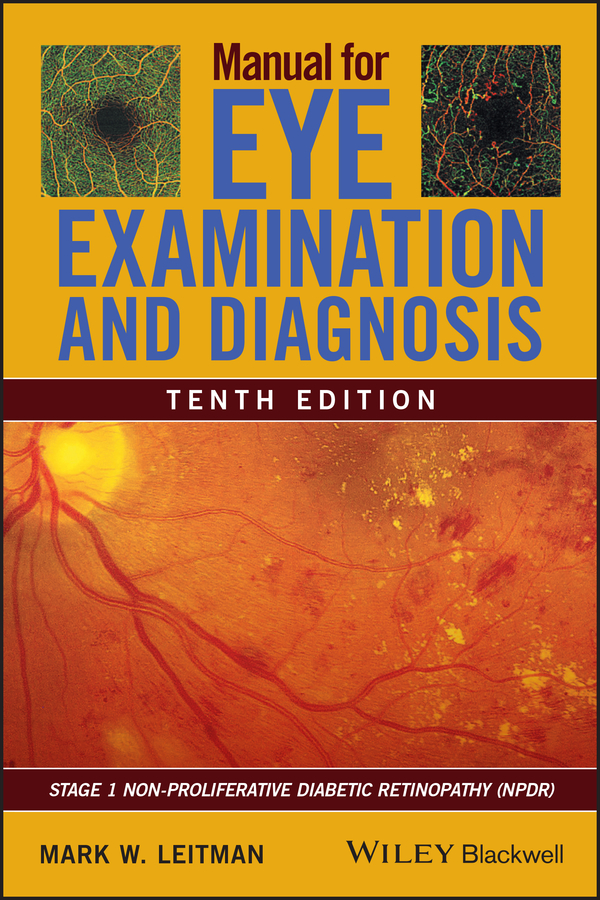 Обложка книги «Manual for Eye Examination and Diagnosis»