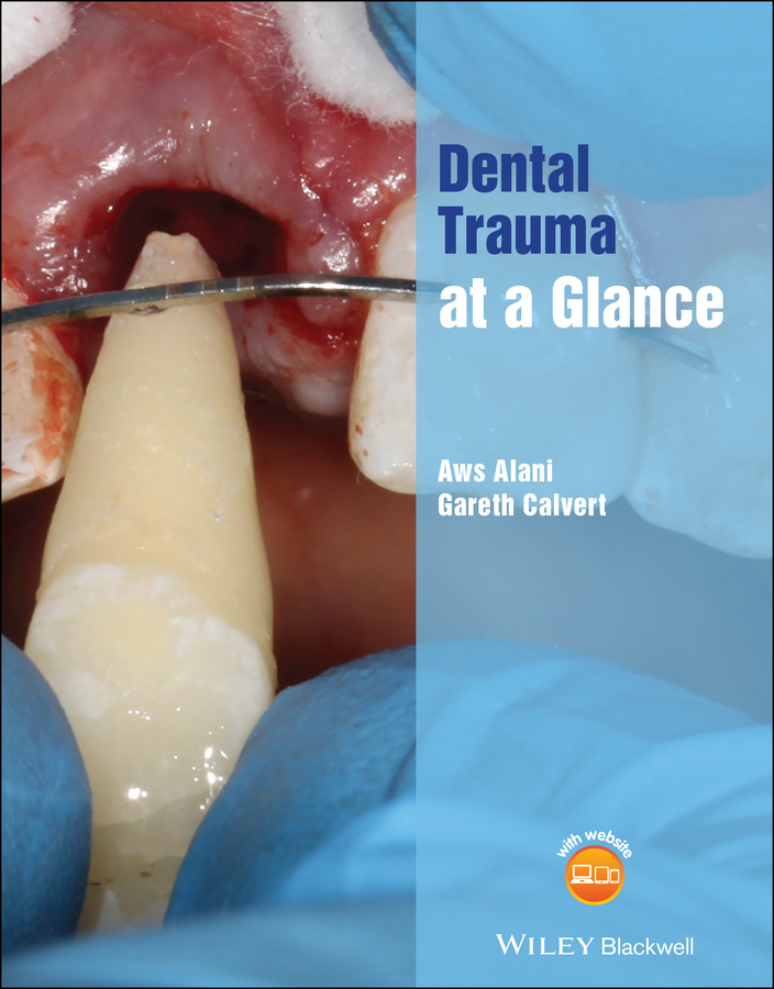 Обложка книги «Dental Trauma at a Glance»
