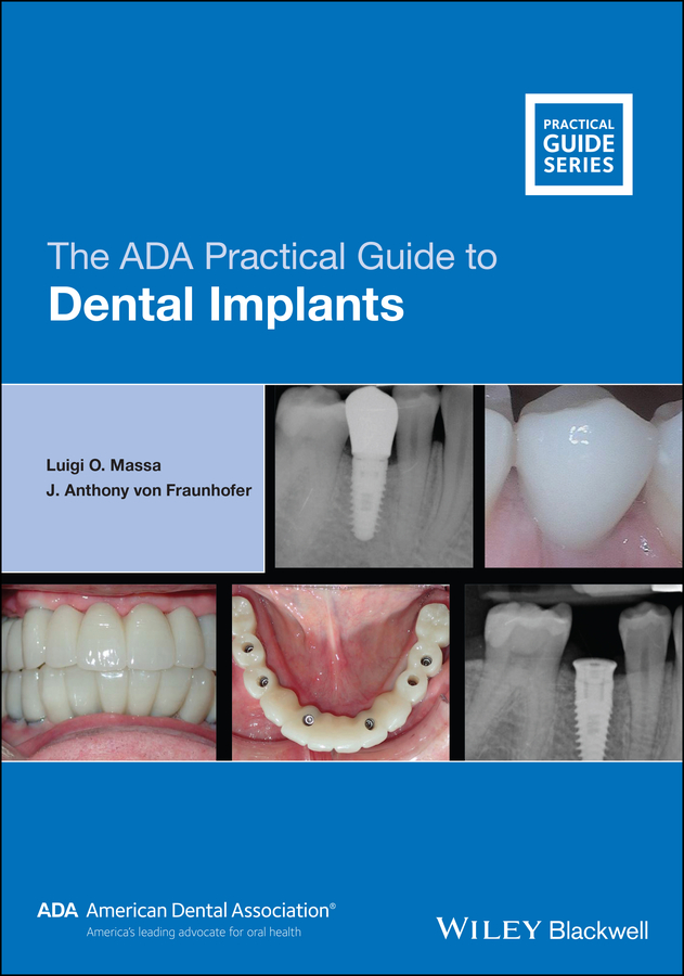 Обложка книги «The ADA Practical Guide to Dental Implants»
