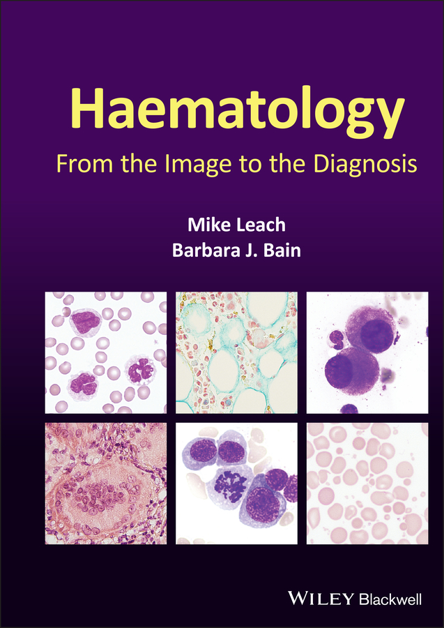 Обложка книги «Haematology»