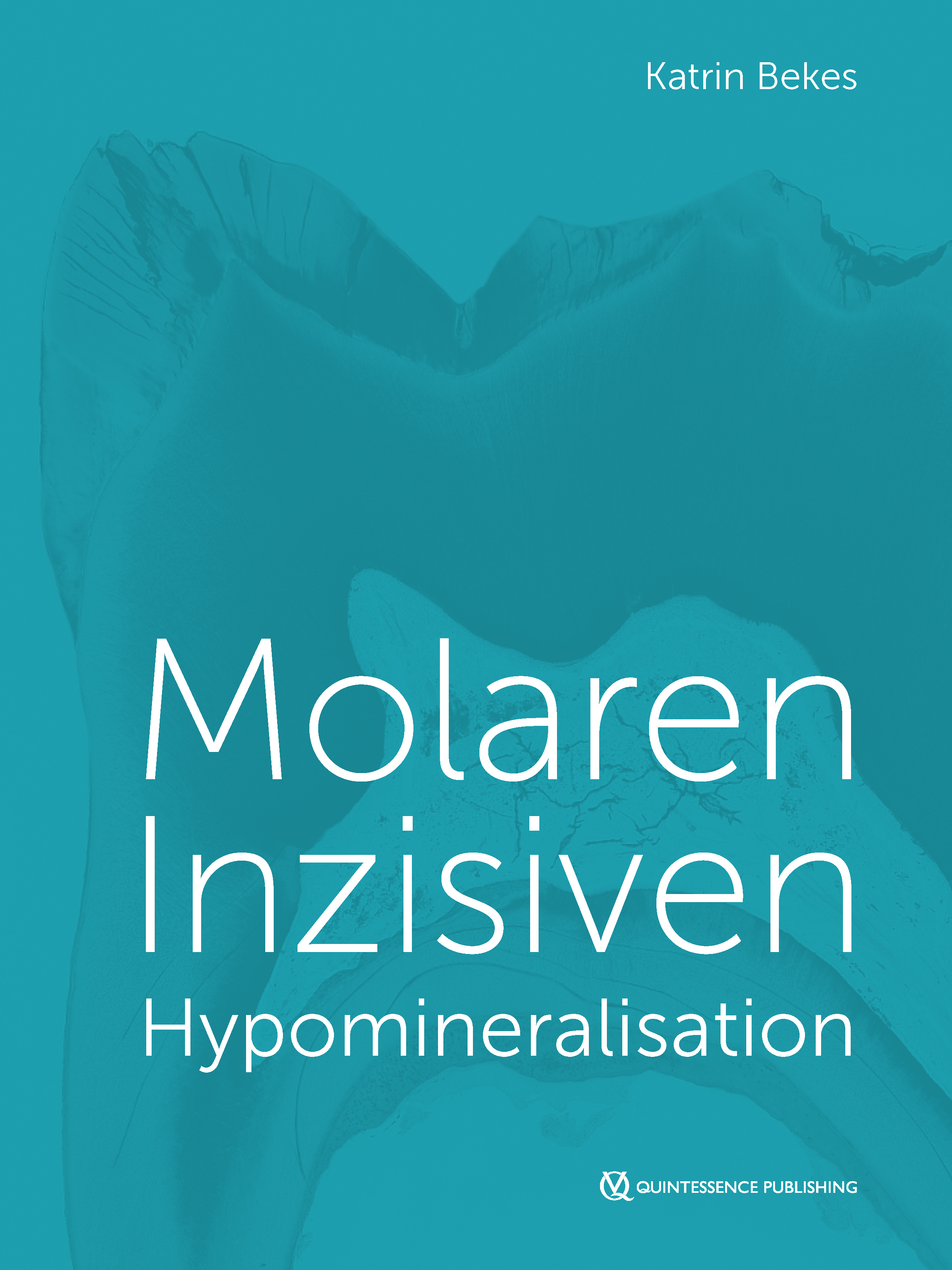 Обложка книги «Molaren-Inzisiven-Hypomineralisation»