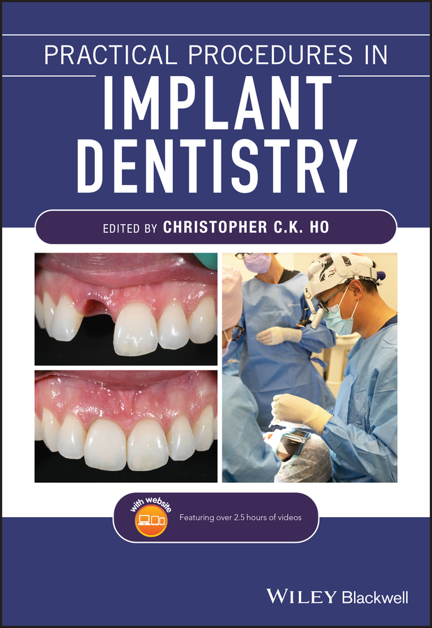 Обложка книги «Practical Procedures in Implant Dentistry»