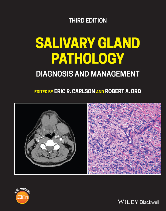 Обложка книги «Salivary Gland Pathology»