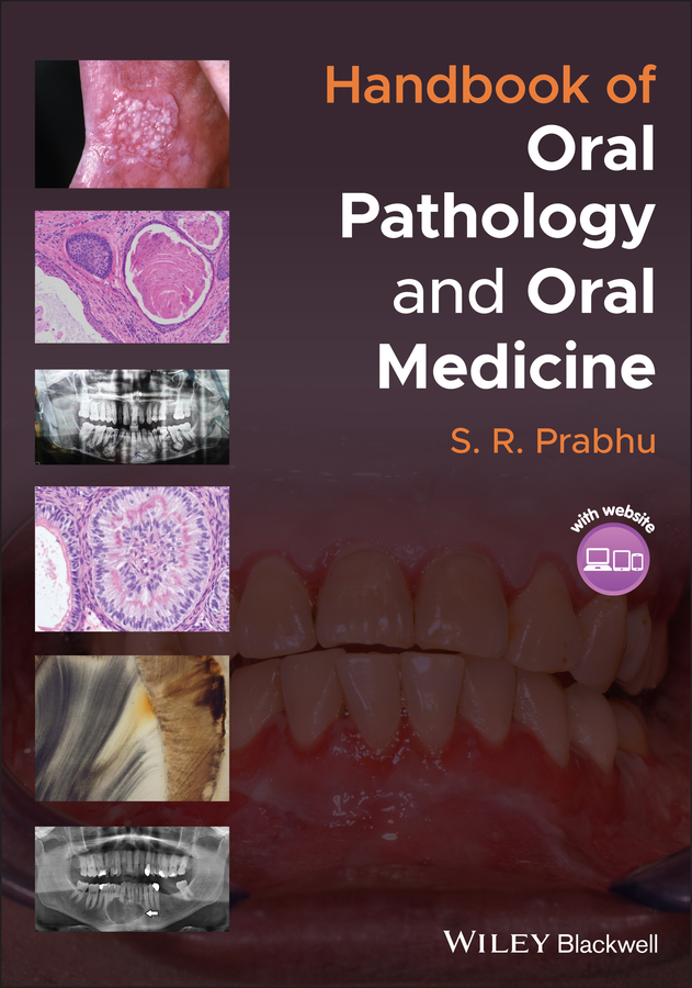 Обложка книги «Handbook of Oral Pathology and Oral Medicine»