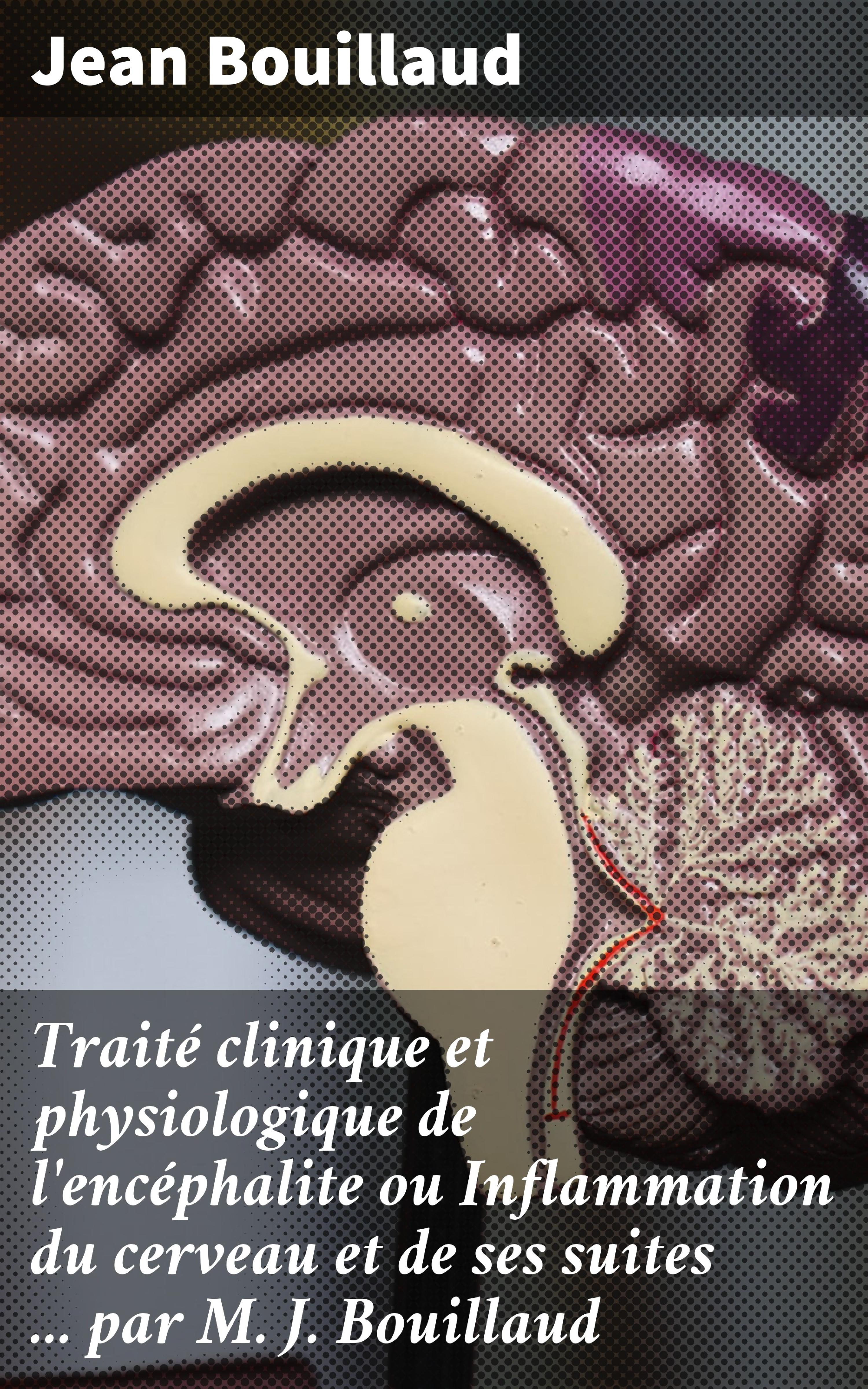Обложка книги «Traité clinique et physiologique de l'encéphalite ou Inflammation du cerveau et de ses suites ... par M. J. Bouillaud»