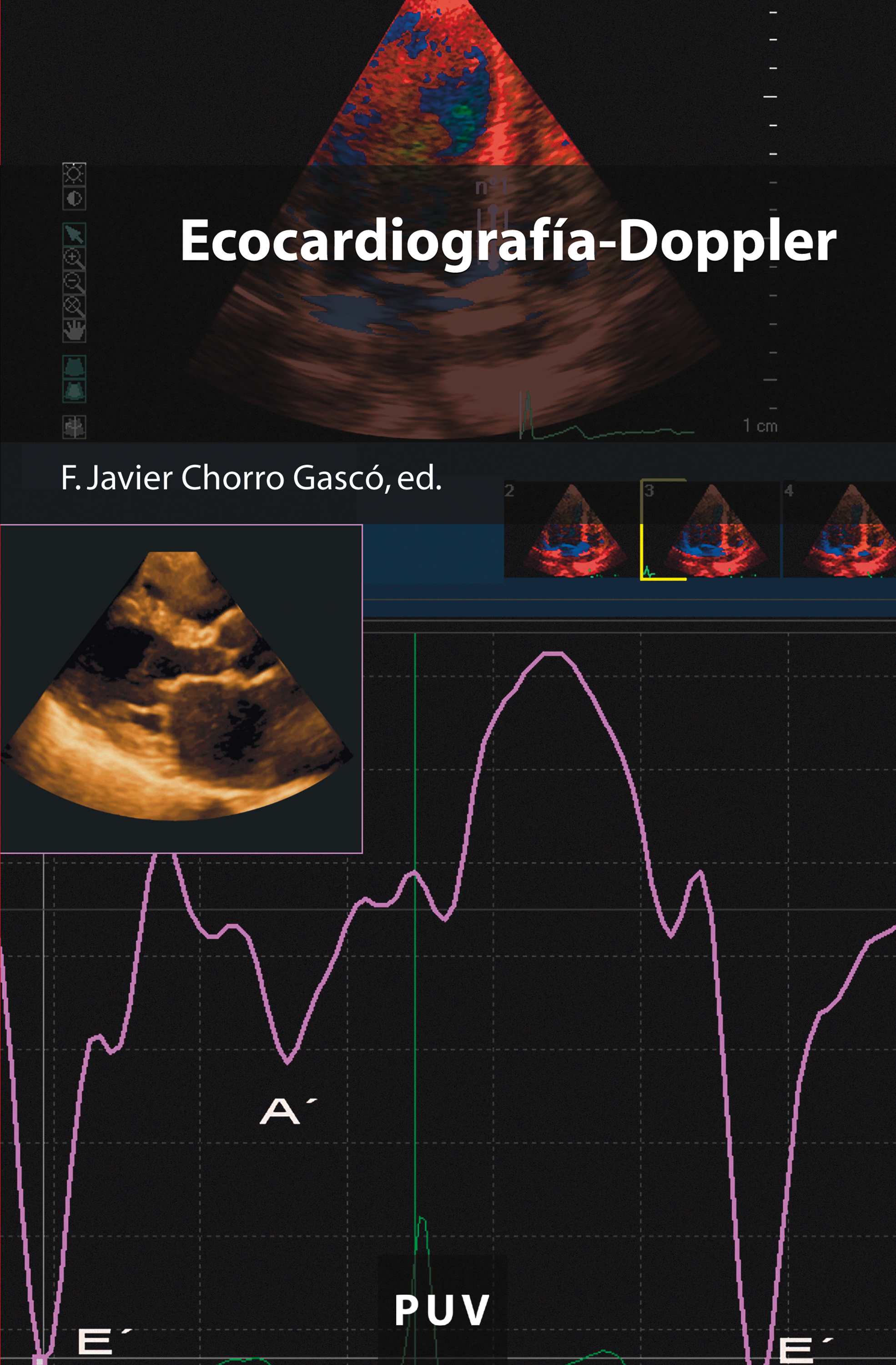 Обложка книги «Ecocardiografía-Doppler»