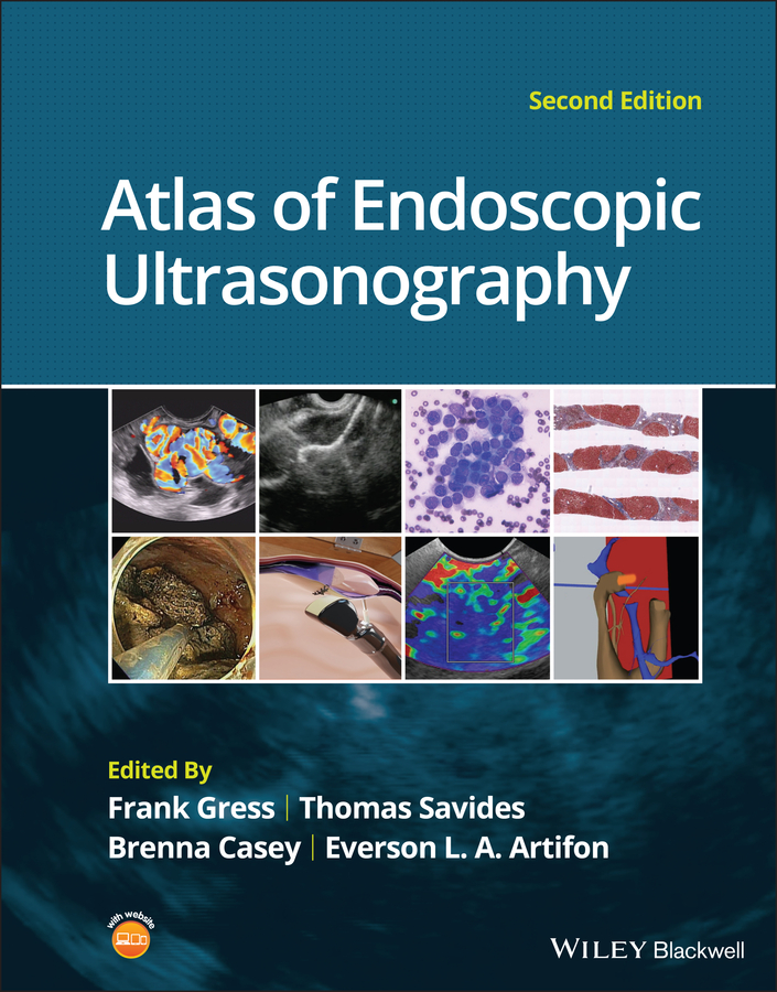 Обложка книги «Atlas of Endoscopic Ultrasonography»