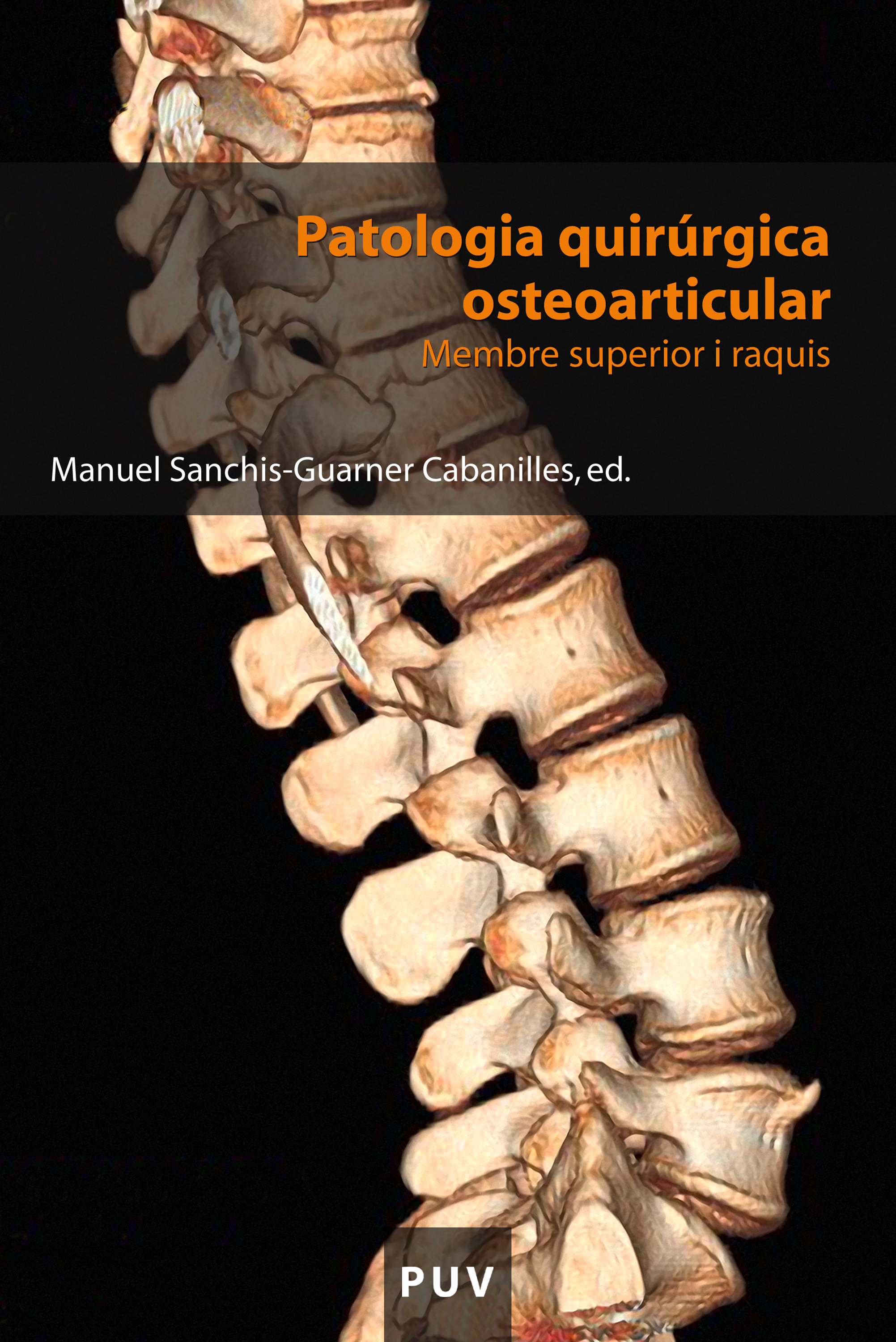 Обложка книги «Patologia quirúrgica osteoarticular»