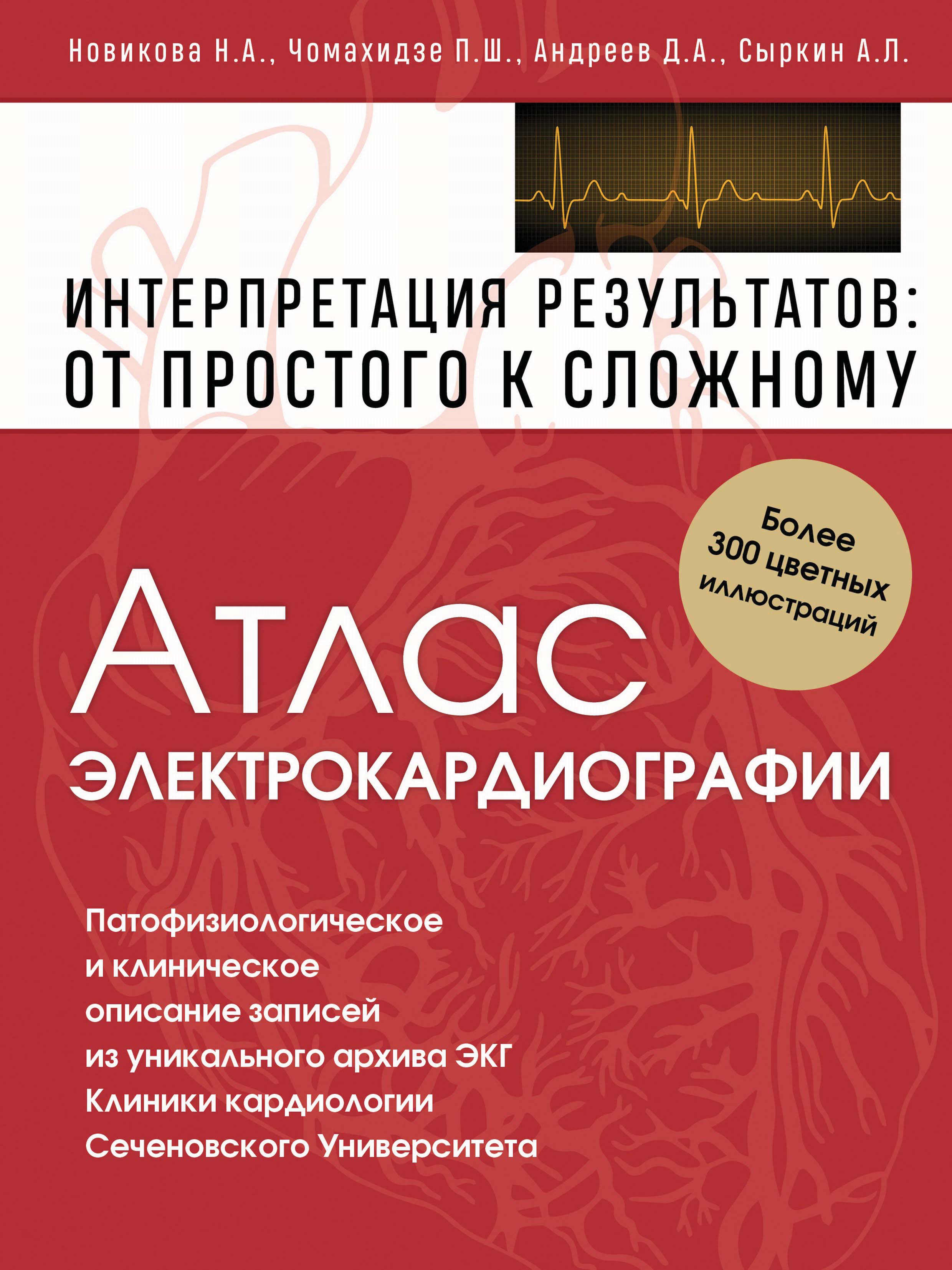 Обложка книги «Атлас электрокардиографии. Интерпретация результатов: от простого к сложному»
