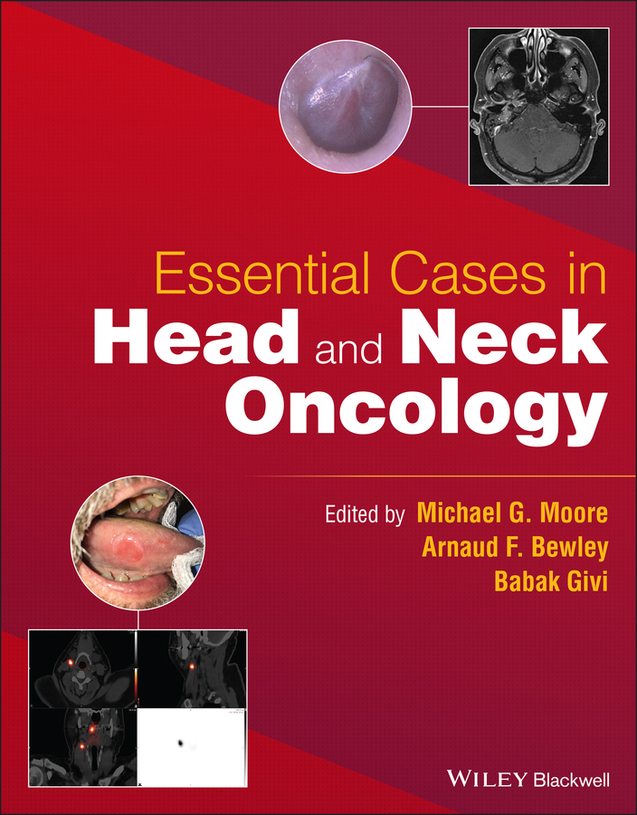 Обложка книги «Essential Cases in Head and Neck Oncology»