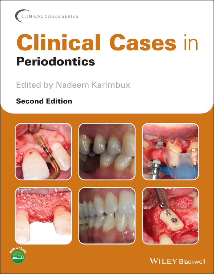 Обложка книги «Clinical Cases in Periodontics»