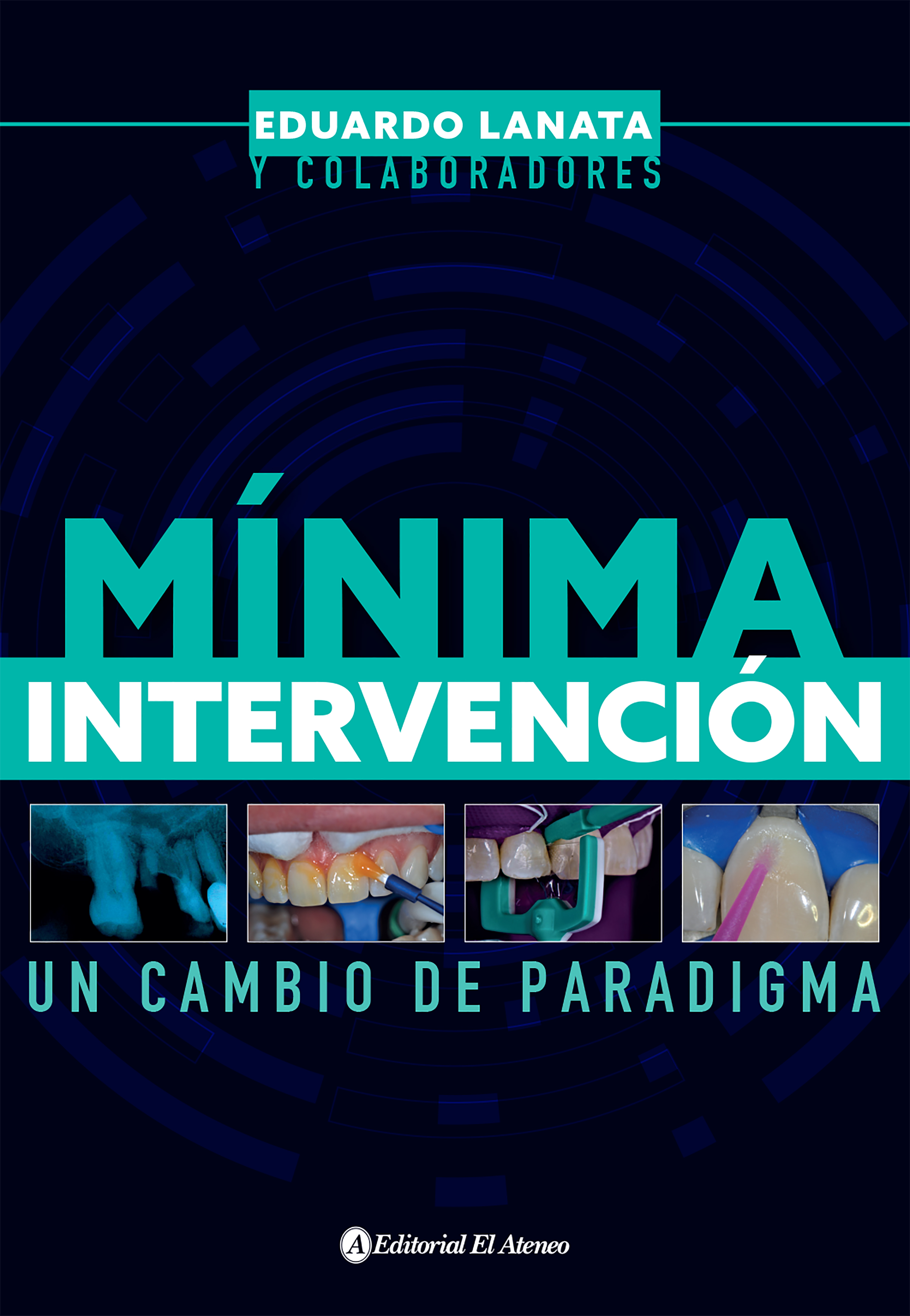 Обложка книги «Mínima intervención»