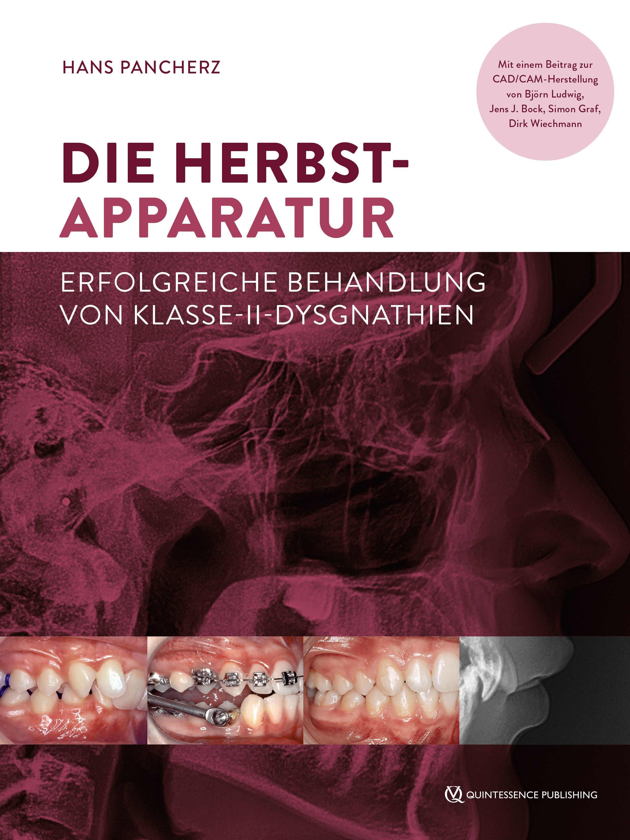 Обложка книги «Die Herbst-Apparatur»