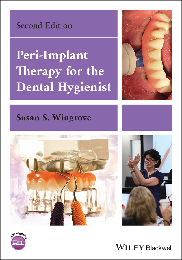 Обложка книги «Peri-Implant Therapy for the Dental Hygienist»