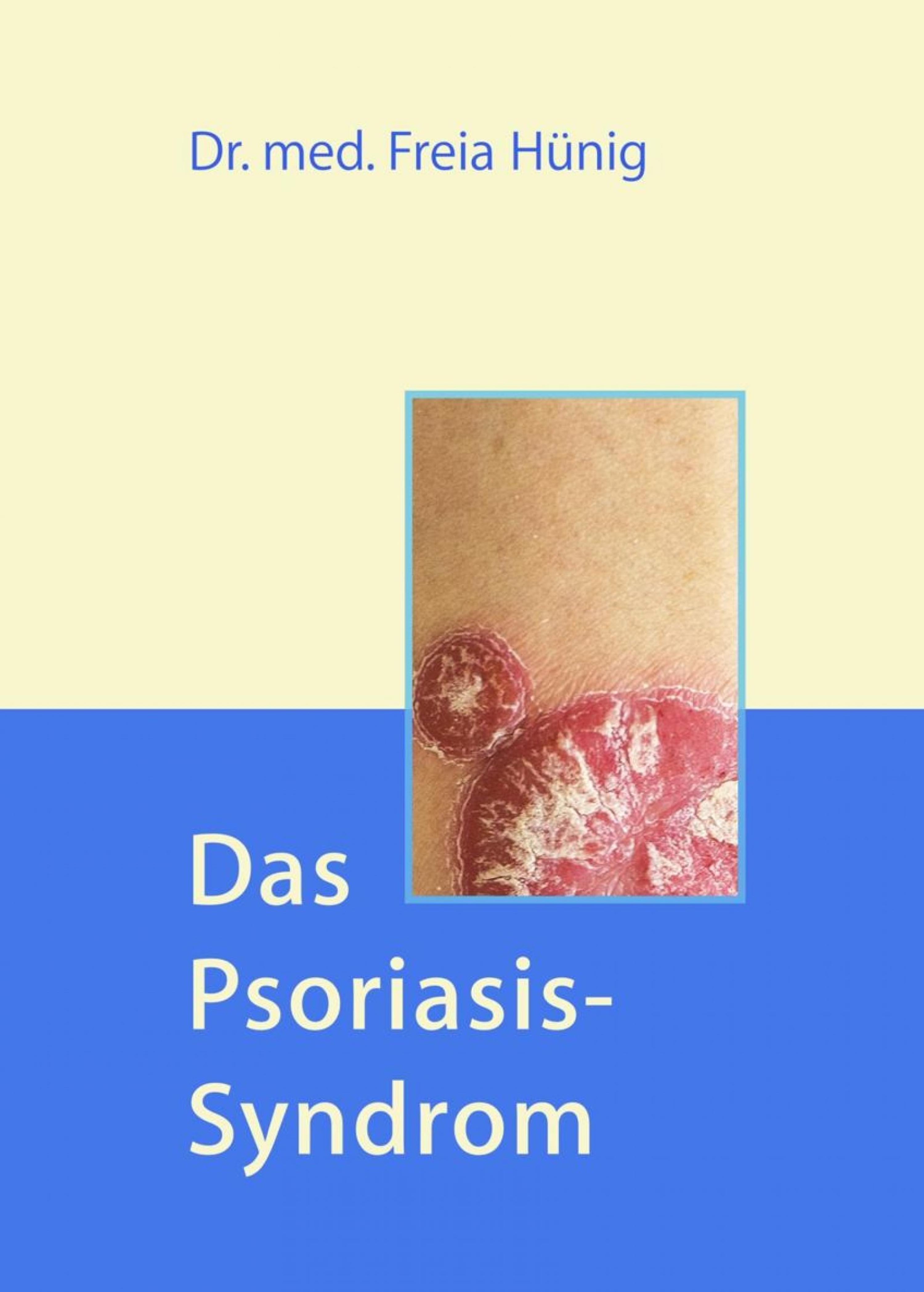 Обложка книги «Das Psoriasis-Syndrom»