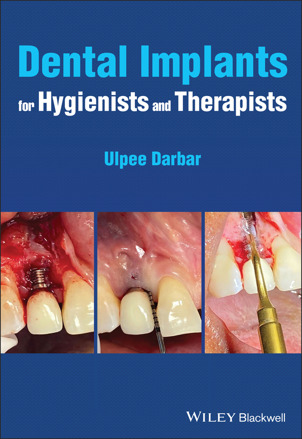 Обложка книги «Dental Implants for Hygienists and Therapists»