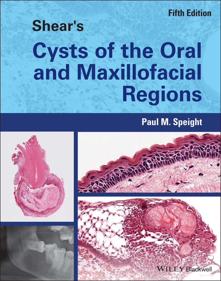 Обложка книги «Shear's Cysts of the Oral and Maxillofacial Regions»