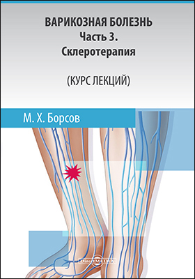 Обложка книги «Варикозная болезнь: Часть 3»