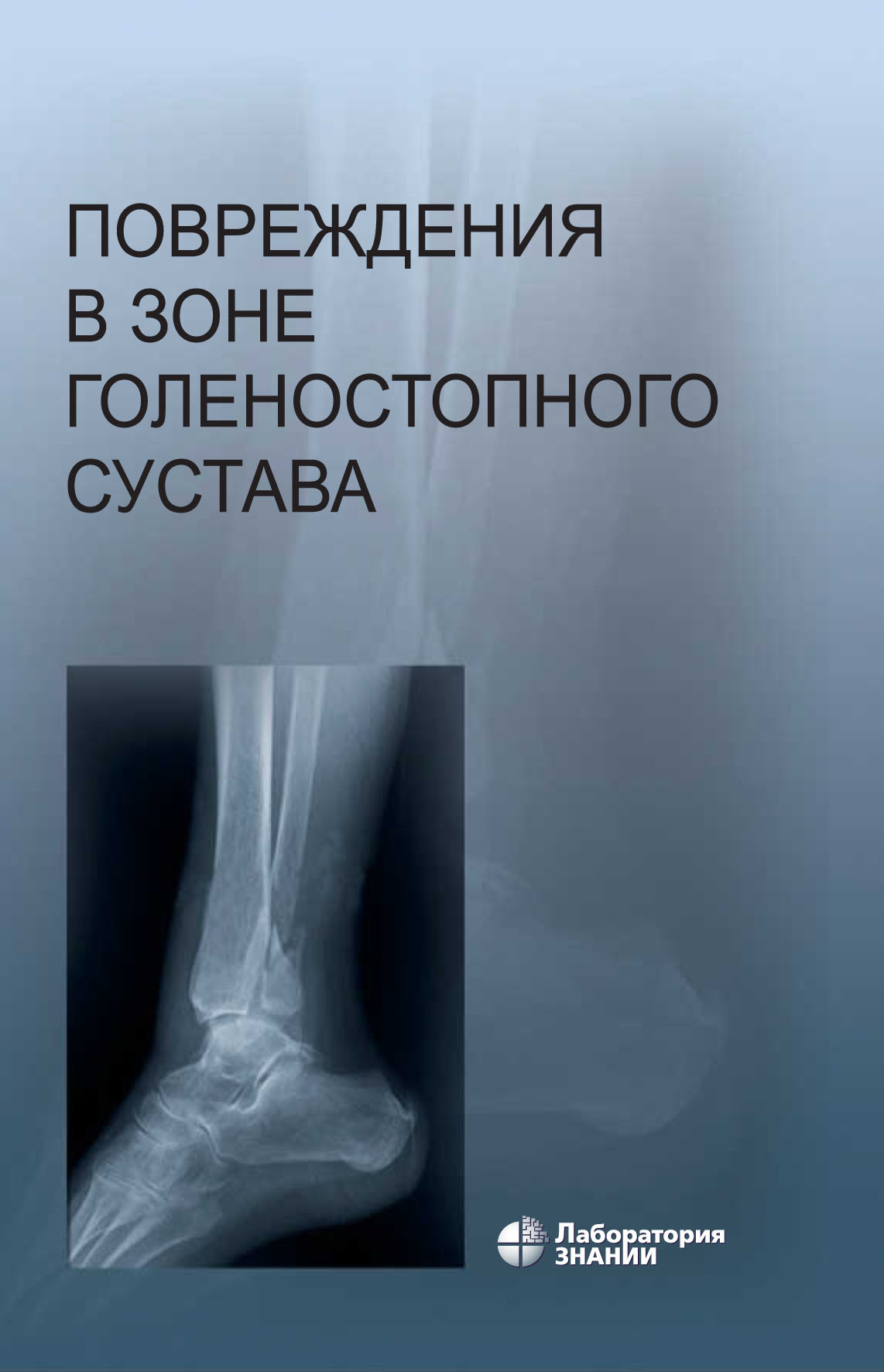 Обложка книги «Повреждения в зоне голеностопного сустава. Атлас»