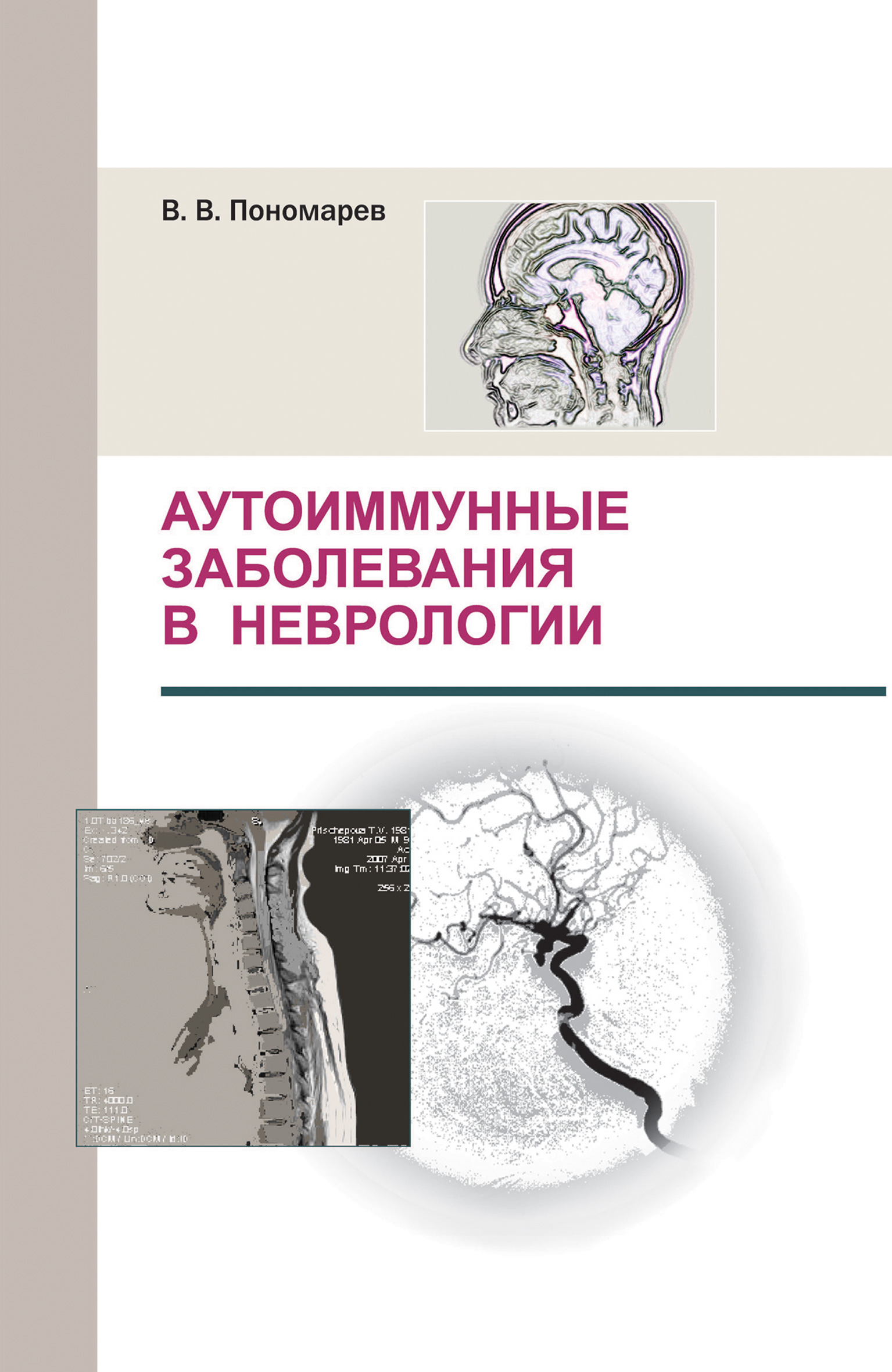 Обложка книги «Аутоиммунные заболевания в неврологии»