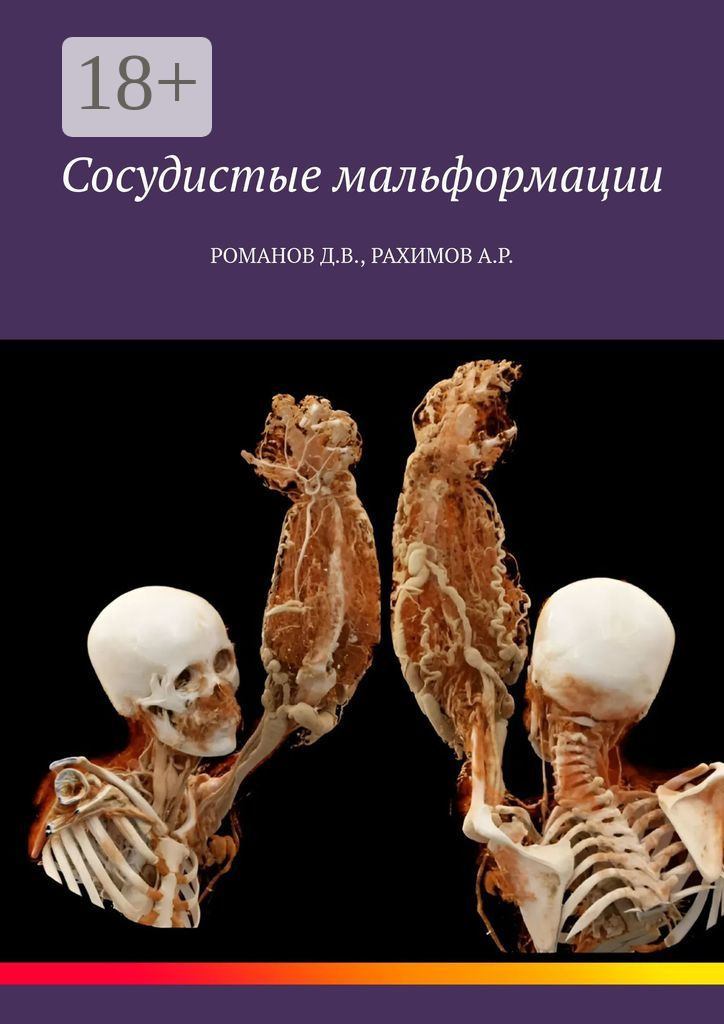Обложка книги «Сосудистые мальформации»