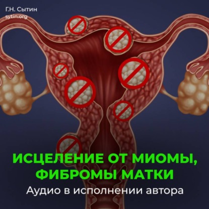 Обложка книги «Исцеление от миомы, фибромы матки»