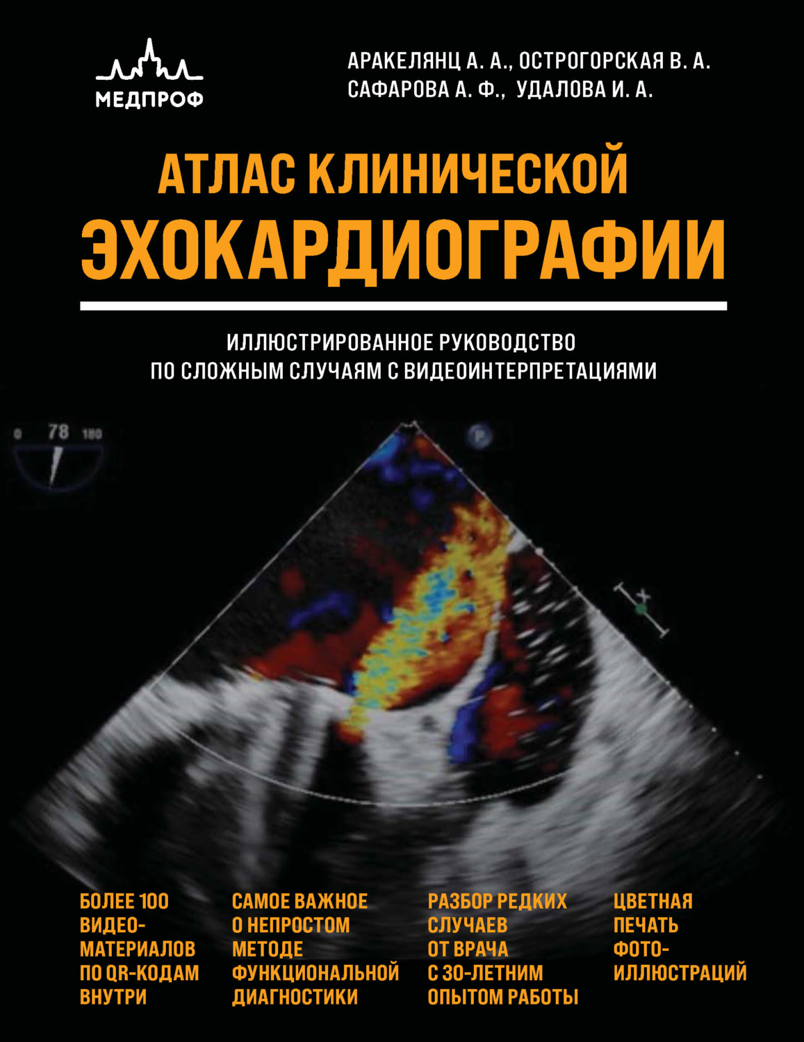 Обложка книги «Атлас ЭхоКГ. Иллюстрированное руководство по сложным случаям с видеоинтерпретациями»