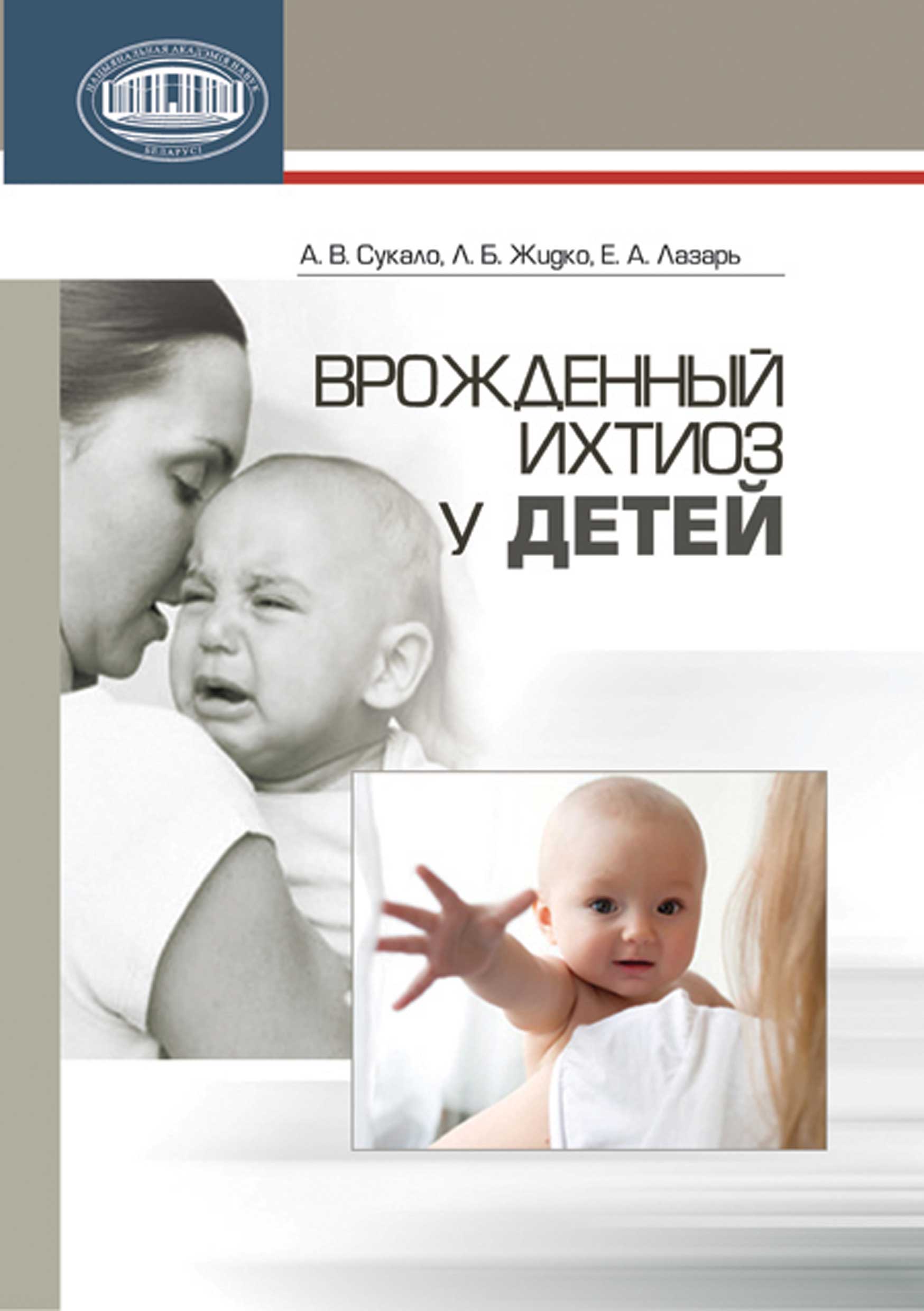 Обложка книги «Врожденный ихтиоз у детей»